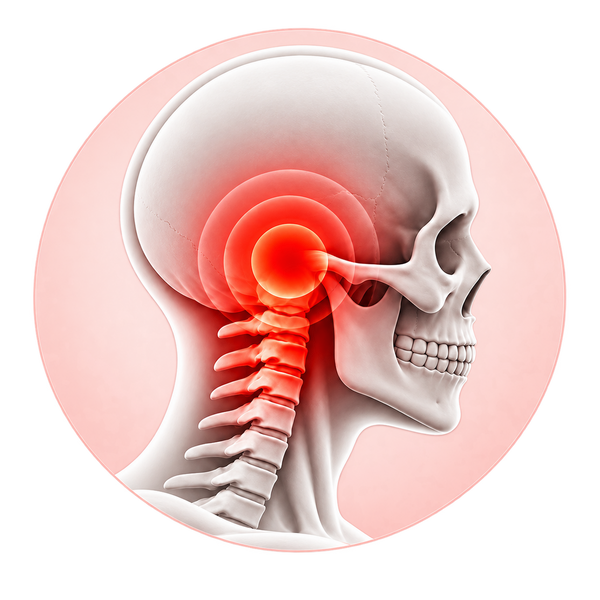 Base-of-Skull Discomfort