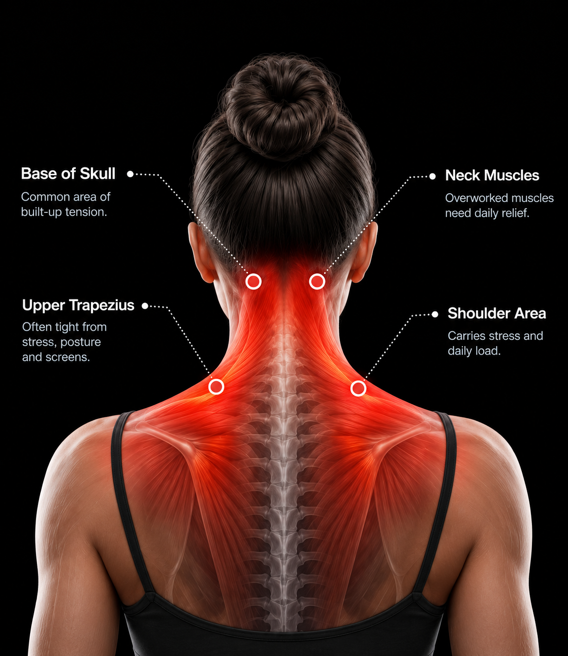 Neck and upper shoulder tension areas