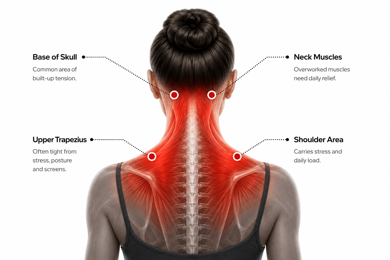 Neck and upper shoulder tension areas